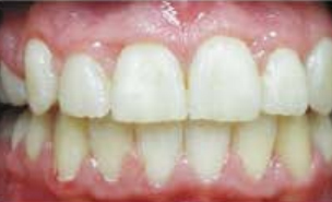 Front Smiling for Virtual Photo